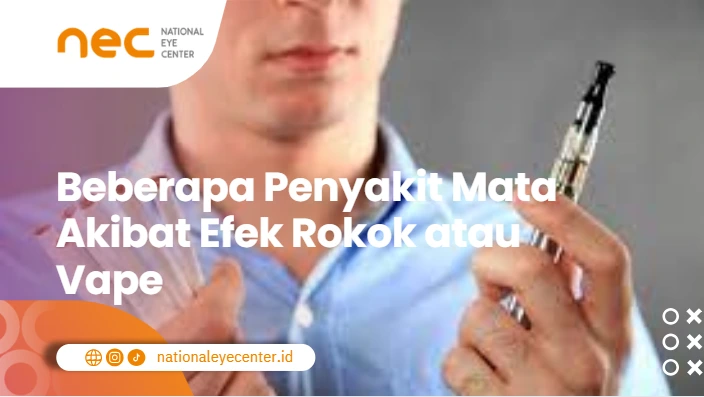Beberapa Penyakit Mata Akibat Efek Rokok atau Vape