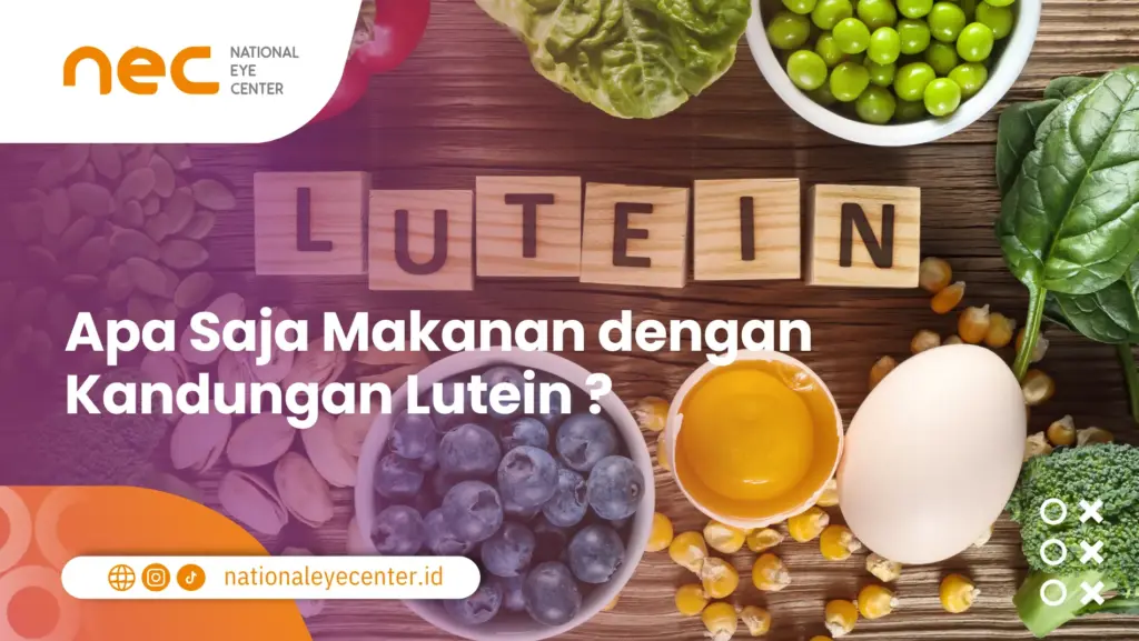 mata minus (2) makanan dengan kandungan lutein