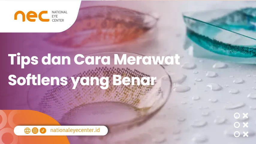 Tips dan Cara Merawat Softlens yang Benar