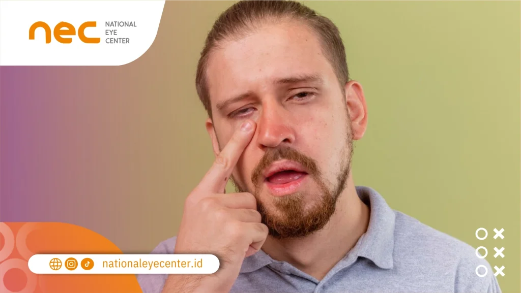 Cara Menghilangkan Kutu di Bulu Mata