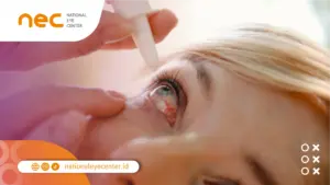 Pengobatan Mata Merah Menular