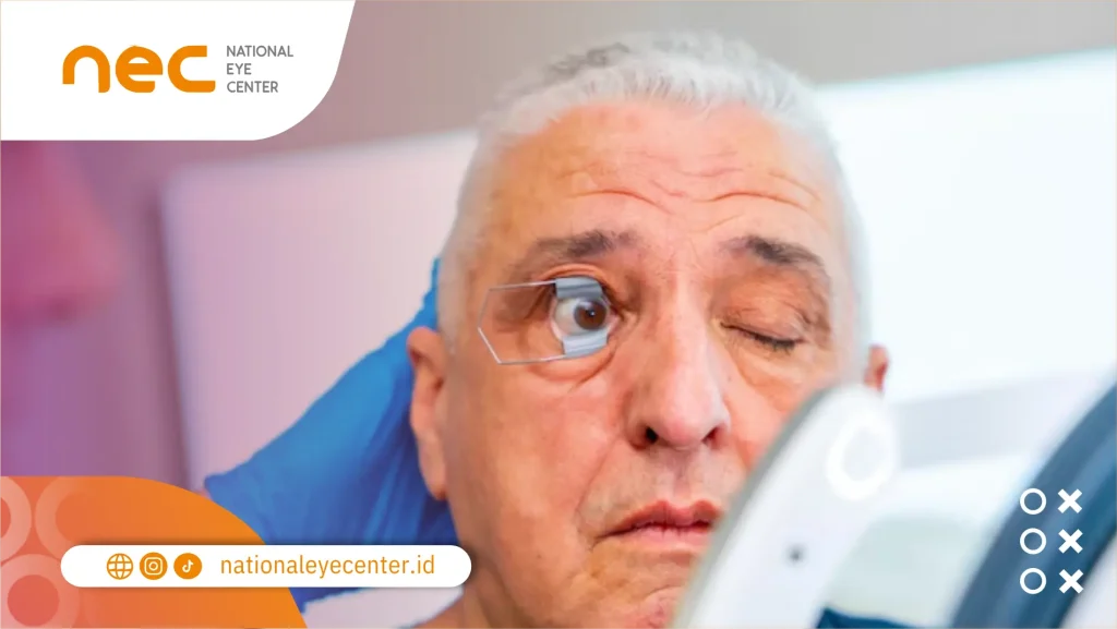 Operasi Katarak Di Tapal Kuda