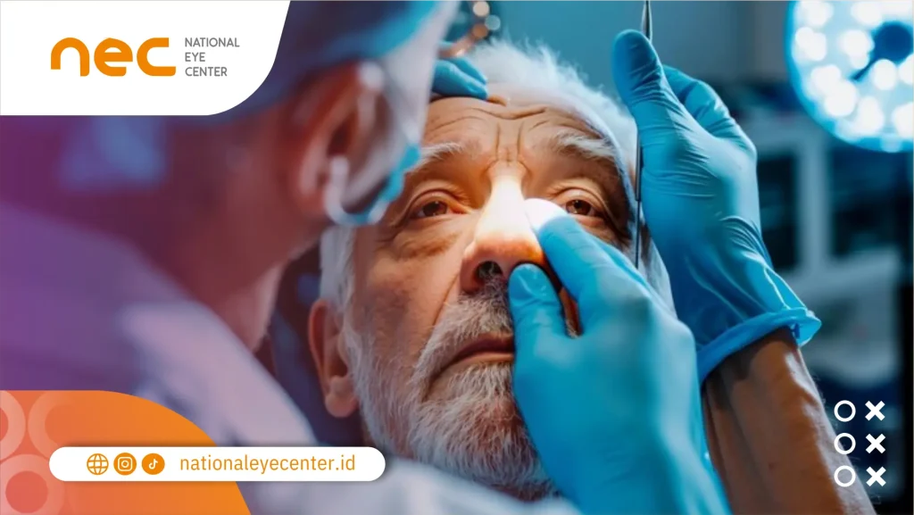 Pilihan Tempat Operasi Katarak di Tuban Dan Bojonegoro