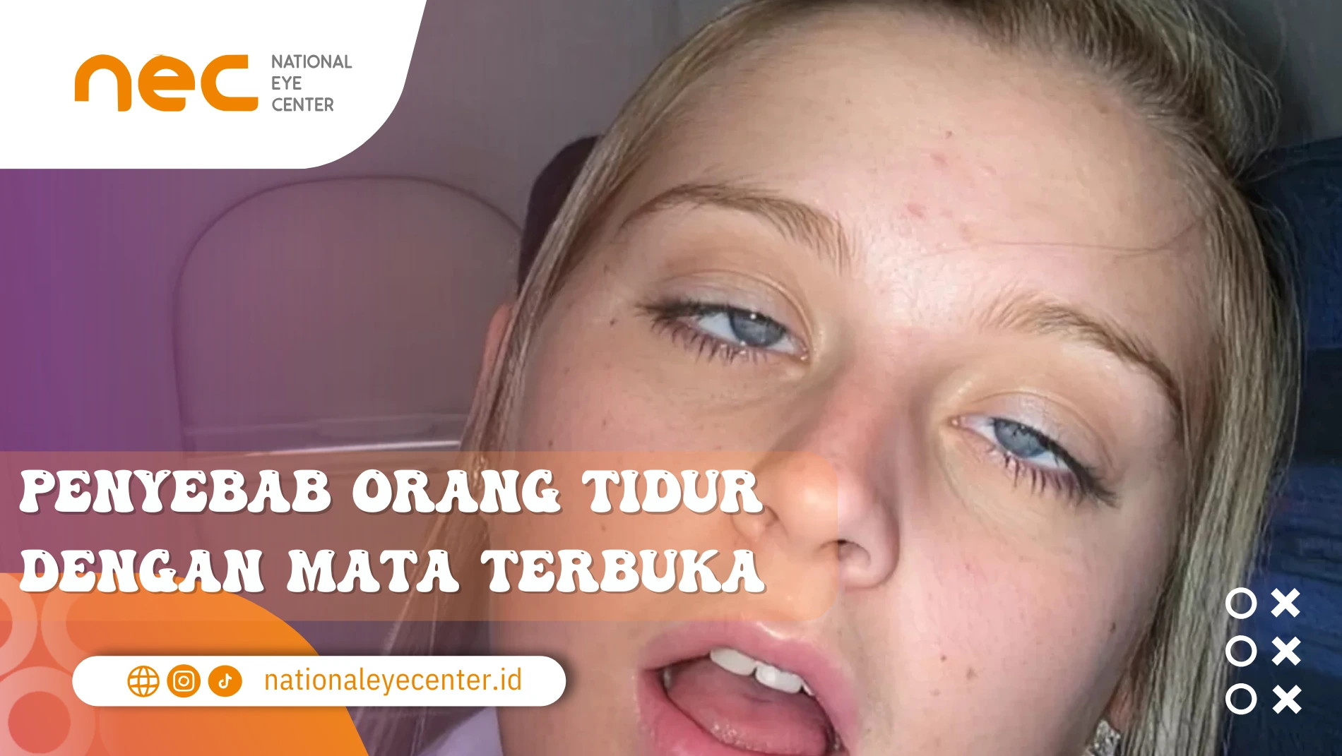 tidur dengan mata terbuka