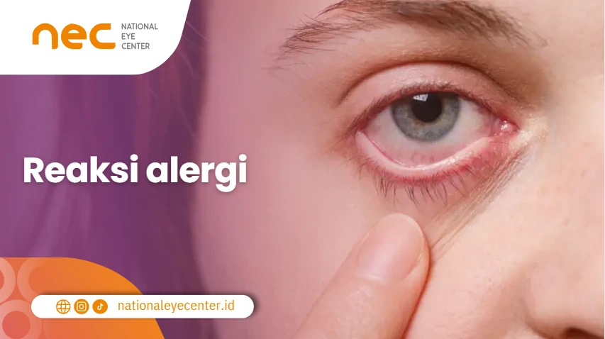 Reaksi alergi