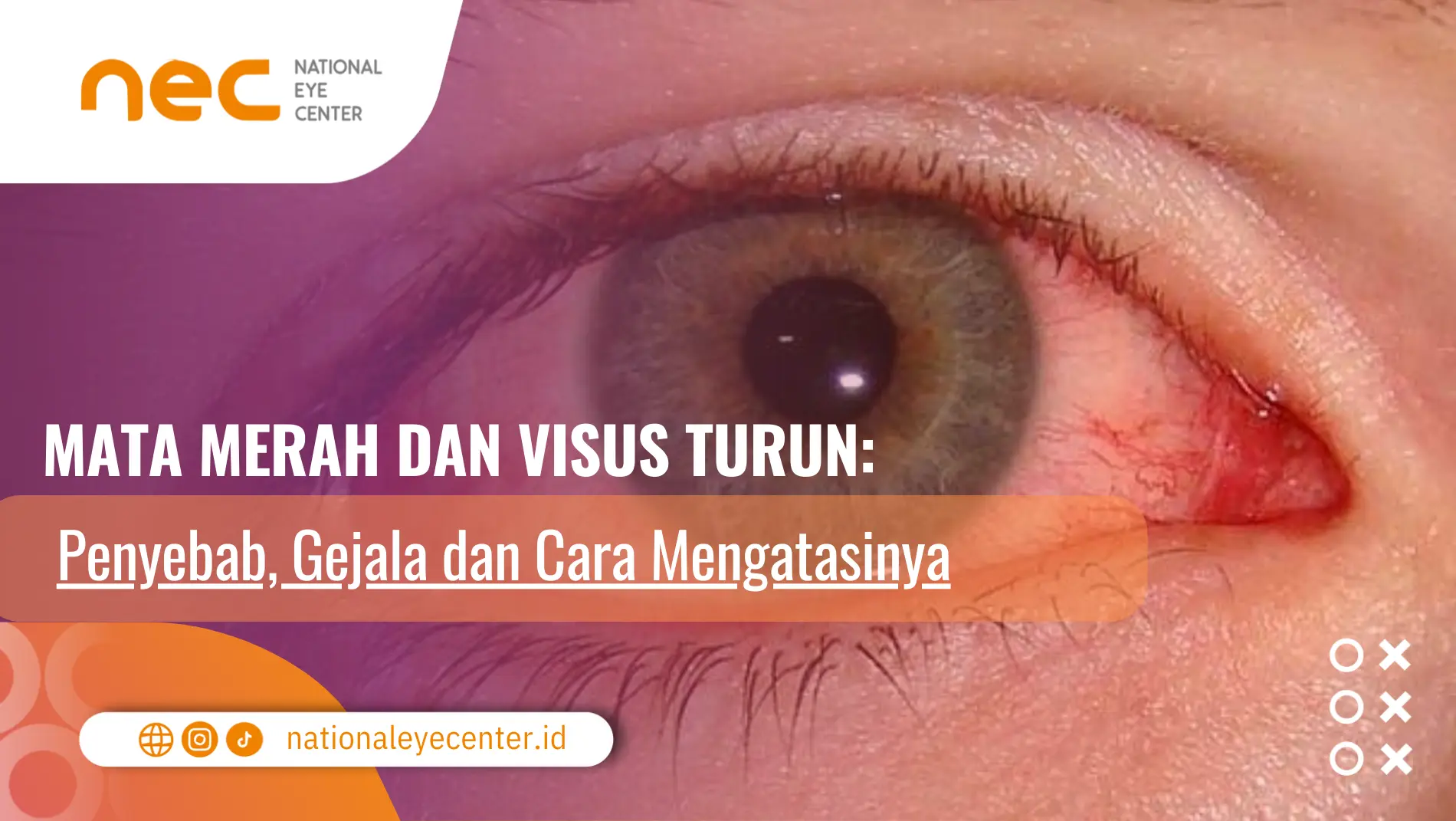 mata merah visus turun