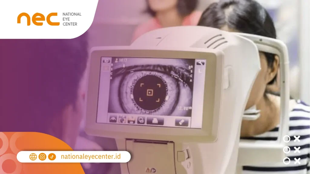 Mata Merah dan Visus Turun: Penyebab, Gejala dan Cara Mengatasinya mata merah visus turun