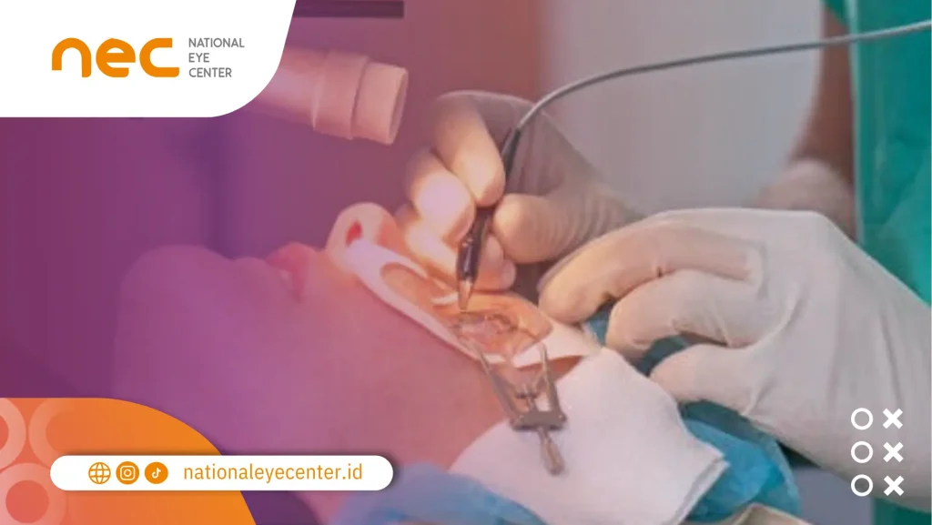 mata merah visus turun