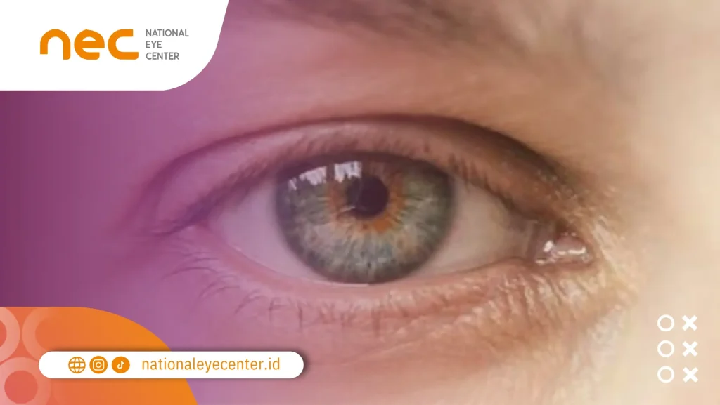 Apakah Warna Mata bisa Berubah? Ini Penjelasannya warna mata berubah