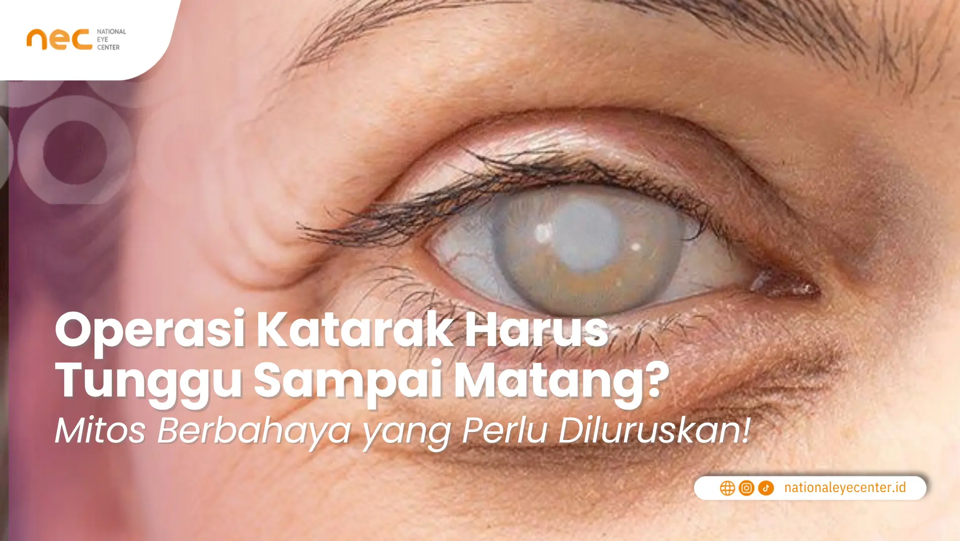 operasi katarak harus tunggu matang