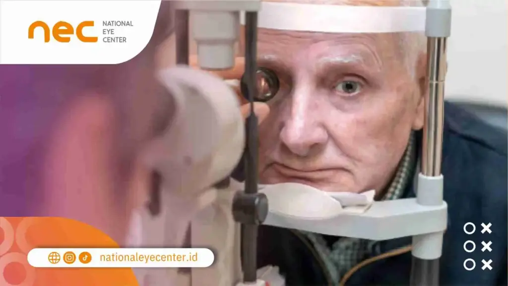 Bagaimana Cara Menangani Mata Keruh?