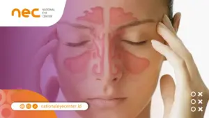 Cara Mengatasi Pusing di Belakang Mata