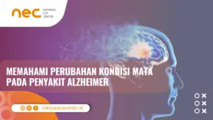 kondisi mata dengan penyakit Alzheimer