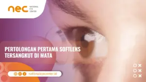 softlens tersangkut di mata
