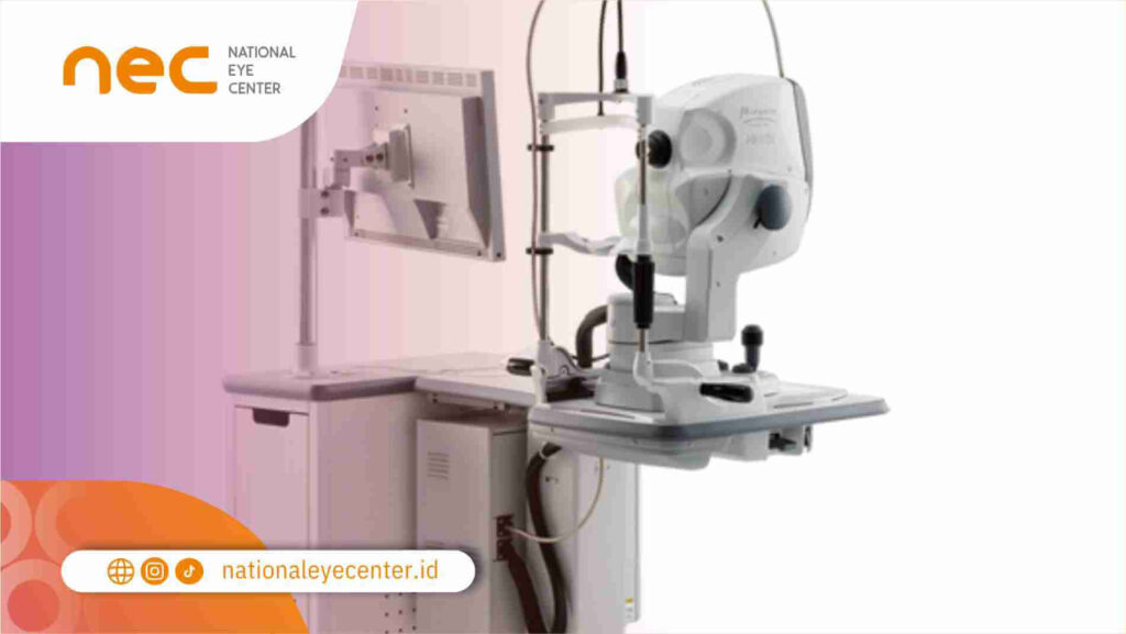 Scanning Laser Ophthalmoscopy (SLO)
