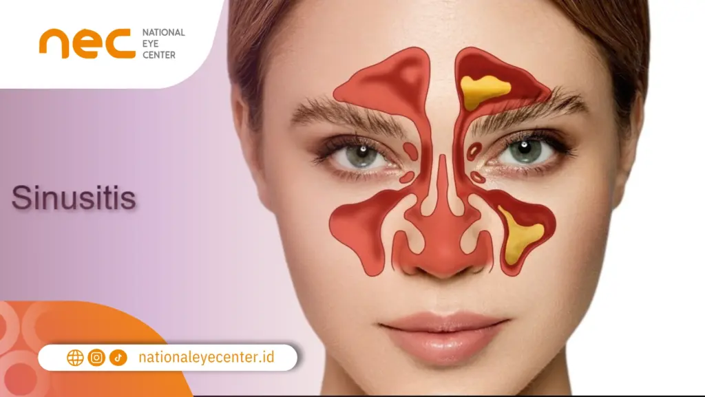 sakit kepala sebelah kiri