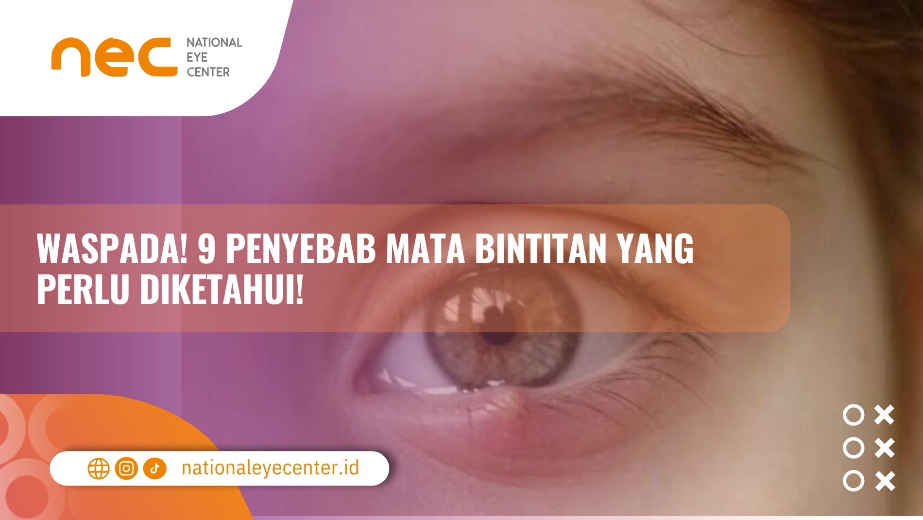 penyebab mata bintitan